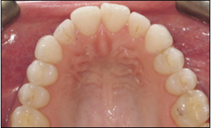 Port Hope Dental - Invisalign