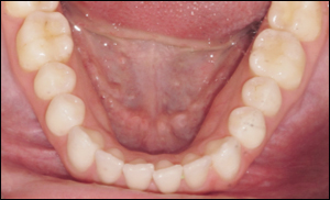 Port Hope Dental - Invisalign