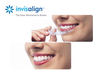 Port Hope Dental - Invisalign